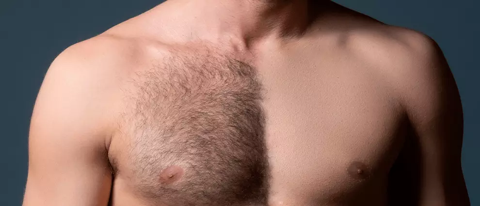 Homens: depilar ou não depilar o corpo?