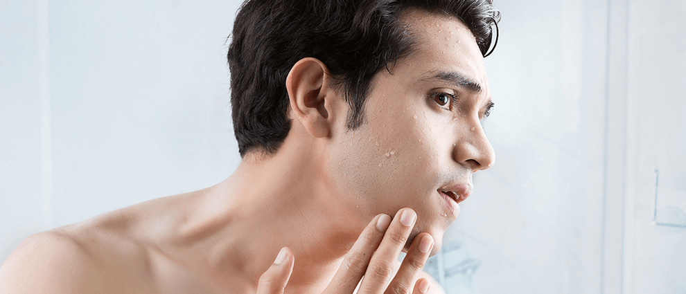 Pele irritada: homem branco jovem sem barba confere a escamação de sua pele no espelho.